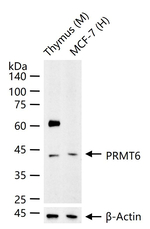 PRMT6 Recombinant Rabbit Monoclonal Antibody (3F11)
