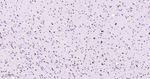 HAT1 Antibody in Immunohistochemistry (Paraffin) (IHC (P))