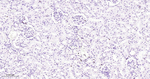 HAT1 Antibody in Immunohistochemistry (Paraffin) (IHC (P))