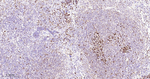 HAT1 Antibody in Immunohistochemistry (Paraffin) (IHC (P))