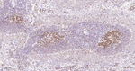 HAT1 Antibody in Immunohistochemistry (Paraffin) (IHC (P))