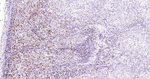 HAT1 Antibody in Immunohistochemistry (Paraffin) (IHC (P))