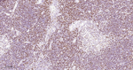 HAT1 Antibody in Immunohistochemistry (Paraffin) (IHC (P))