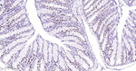 HAT1 Antibody in Immunohistochemistry (Paraffin) (IHC (P))
