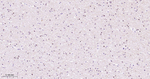 HAT1 Antibody in Immunohistochemistry (Paraffin) (IHC (P))