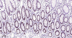 HAT1 Antibody in Immunohistochemistry (Paraffin) (IHC (P))