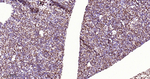 HAT1 Antibody in Immunohistochemistry (Paraffin) (IHC (P))