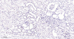 HAT1 Antibody in Immunohistochemistry (Paraffin) (IHC (P))