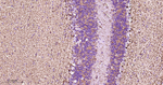 MAOA Antibody in Immunohistochemistry (Paraffin) (IHC (P))