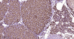 MAOA Antibody in Immunohistochemistry (Paraffin) (IHC (P))