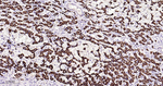 MAOA Antibody in Immunohistochemistry (Paraffin) (IHC (P))