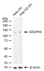 GOLIM4 Recombinant Rabbit Monoclonal Antibody (12A8)
