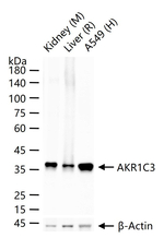 AKR1C3 Recombinant Rabbit Monoclonal Antibody (7A6)