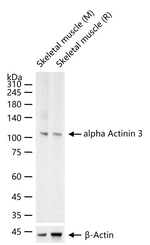 alpha Actinin 3 Recombinant Rabbit Monoclonal Antibody (2B1)