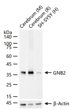 GNB2 Antibody in Western Blot (WB)