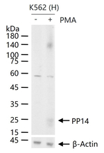 PAEP Recombinant Rabbit Monoclonal Antibody (2G8)