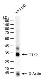 OTX2 Recombinant Rabbit Monoclonal Antibody (5G6)
