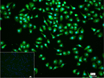 PCYT1A Recombinant Rabbit Monoclonal Antibody (11G12)