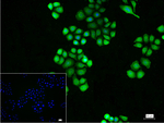 TCP1 Recombinant Rabbit Monoclonal Antibody (5B7)