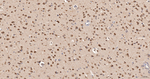 TCP1 Antibody in Immunohistochemistry (Paraffin) (IHC (P))