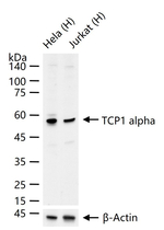 TCP1 Antibody in Western Blot (WB)