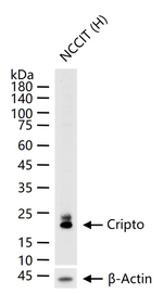 Cripto Recombinant Rabbit Monoclonal Antibody (4E11)