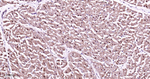 PSMD14 Antibody in Immunohistochemistry (Paraffin) (IHC (P))