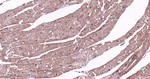 PSMD14 Antibody in Immunohistochemistry (Paraffin) (IHC (P))