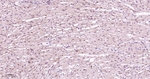 PSMD14 Antibody in Immunohistochemistry (Paraffin) (IHC (P))