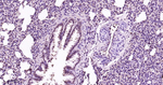 PSMD14 Antibody in Immunohistochemistry (Paraffin) (IHC (P))