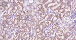 ABAT Antibody in Immunohistochemistry (Paraffin) (IHC (P))