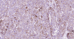 ABAT Antibody in Immunohistochemistry (Paraffin) (IHC (P))