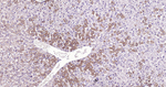 ABAT Antibody in Immunohistochemistry (Paraffin) (IHC (P))