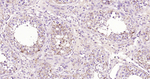 ABAT Antibody in Immunohistochemistry (Paraffin) (IHC (P))
