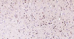 ABAT Antibody in Immunohistochemistry (Paraffin) (IHC (P))