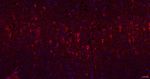 ABAT Antibody in Immunohistochemistry (Paraffin) (IHC (P))