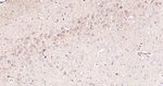 ABAT Antibody in Immunohistochemistry (Paraffin) (IHC (P))