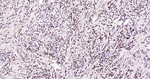 ABAT Antibody in Immunohistochemistry (Paraffin) (IHC (P))