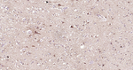 ABAT Antibody in Immunohistochemistry (Paraffin) (IHC (P))