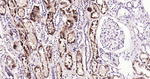 ABAT Antibody in Immunohistochemistry (Paraffin) (IHC (P))