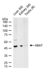 ABAT Antibody in Western Blot (WB)