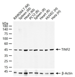 TIN2 Recombinant Rabbit Monoclonal Antibody (7B2)