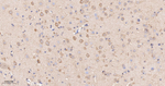 TCP-1 beta Antibody in Immunohistochemistry (Paraffin) (IHC (P))