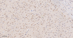 TCP-1 beta Antibody in Immunohistochemistry (Paraffin) (IHC (P))