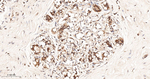 TCP-1 beta Recombinant Rabbit Monoclonal Antibody (11C3)