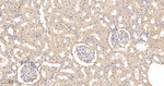 TCP-1 beta Antibody in Immunohistochemistry (Paraffin) (IHC (P))