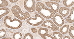 TCP-1 beta Antibody in Immunohistochemistry (Paraffin) (IHC (P))