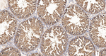TCP-1 beta Antibody in Immunohistochemistry (Paraffin) (IHC (P))