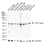 TCP-1 beta Antibody in Western Blot (WB)