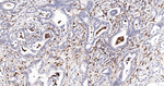 GRB2 Recombinant Rabbit Monoclonal Antibody (3D6)